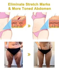 Rolimey® Advanced Firming & Wrinkle-Reducing Cream