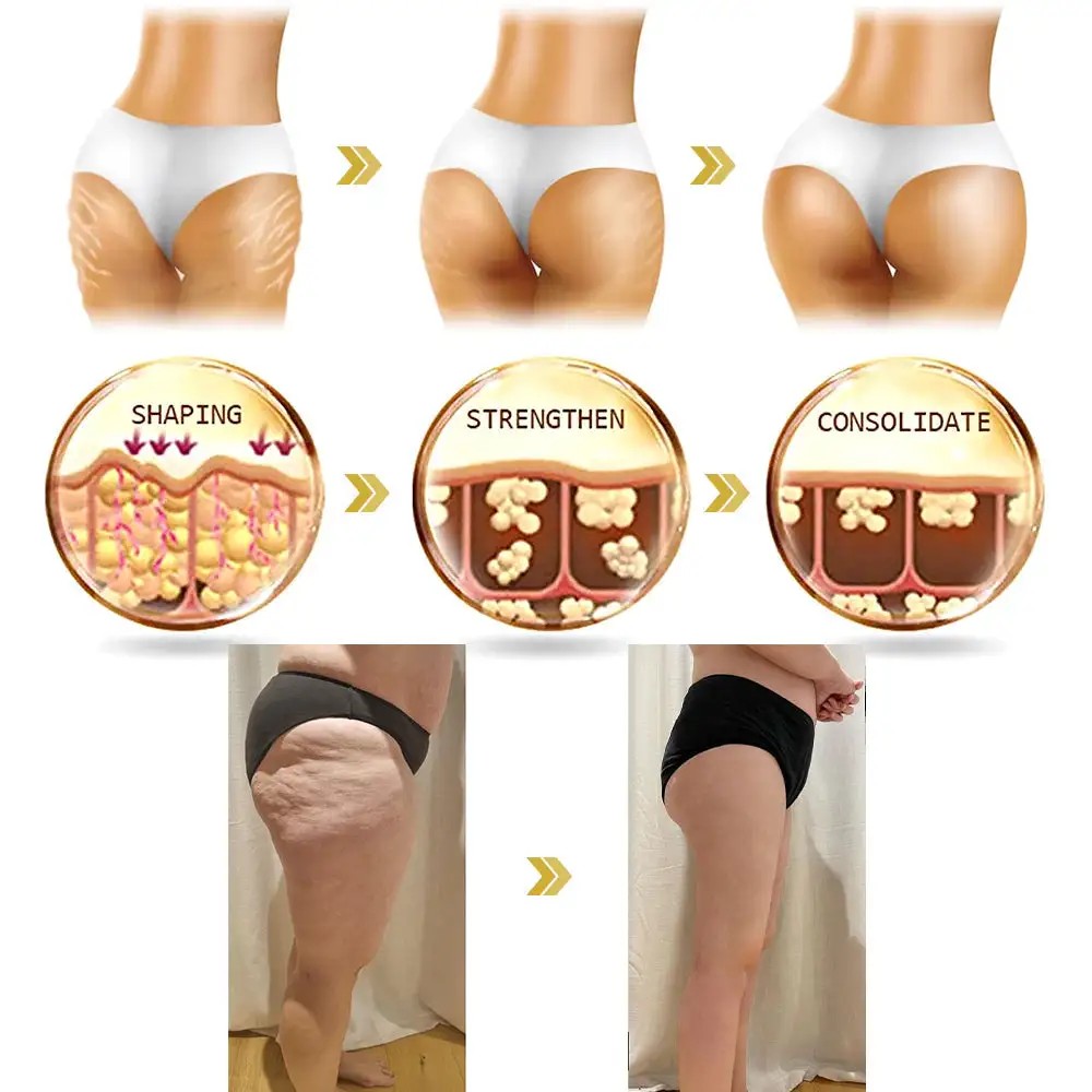 Rolimey® Advanced Firming & Wrinkle-Reducing Cream