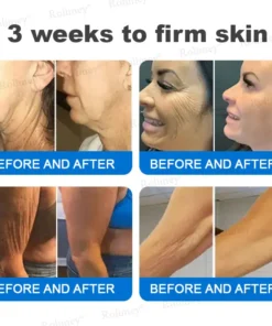 Rolimey® Advanced Firming & Wrinkle-Reducing Cream