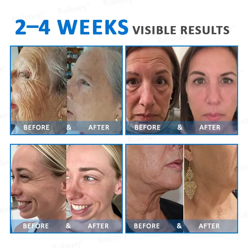 Rolimey® Advanced Firming & Wrinkle-Reducing Cream