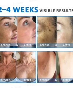 Rolimey® Advanced Firming & Wrinkle-Reducing Cream