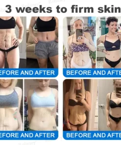 Rolimey® Advanced Firming & Wrinkle-Reducing Cream