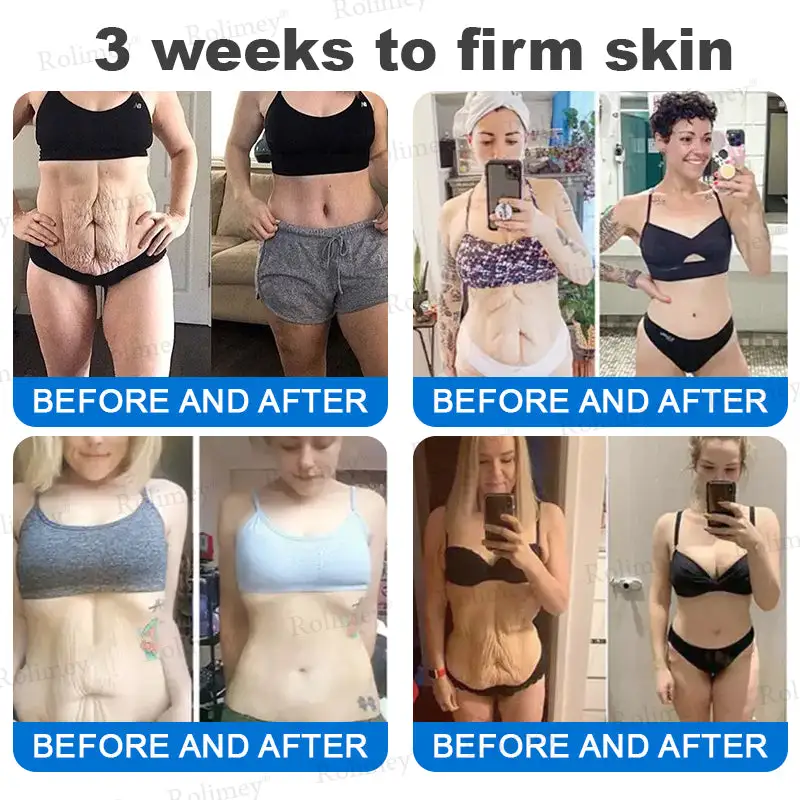 Rolimey® Advanced Firming & Wrinkle-Reducing Cream