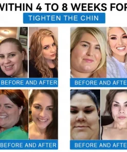 Vaxflite® SMGT-GLP-1 𝐓𝐢𝐫𝐳𝐞𝐩𝐚𝐭𝐢𝐝𝐞 & 𝐂𝐨𝐥𝐥𝐚𝐠𝐞𝐧 𝐍𝐚𝐧𝐨 𝐌𝐢𝐜𝐫𝐨𝐧𝐞𝐞𝐝𝐥𝐞 𝐖𝐞𝐢𝐠𝐡𝐭 𝐋𝐨𝐬𝐬 𝐏𝐚𝐭𝐜𝐡