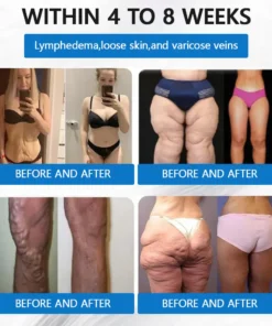 Vaxflite® SMGT-GLP-1 𝐓𝐢𝐫𝐳𝐞𝐩𝐚𝐭𝐢𝐝𝐞 & 𝐂𝐨𝐥𝐥𝐚𝐠𝐞𝐧 𝐍𝐚𝐧𝐨 𝐌𝐢𝐜𝐫𝐨𝐧𝐞𝐞𝐝𝐥𝐞 𝐖𝐞𝐢𝐠𝐡𝐭 𝐋𝐨𝐬𝐬 𝐏𝐚𝐭𝐜𝐡