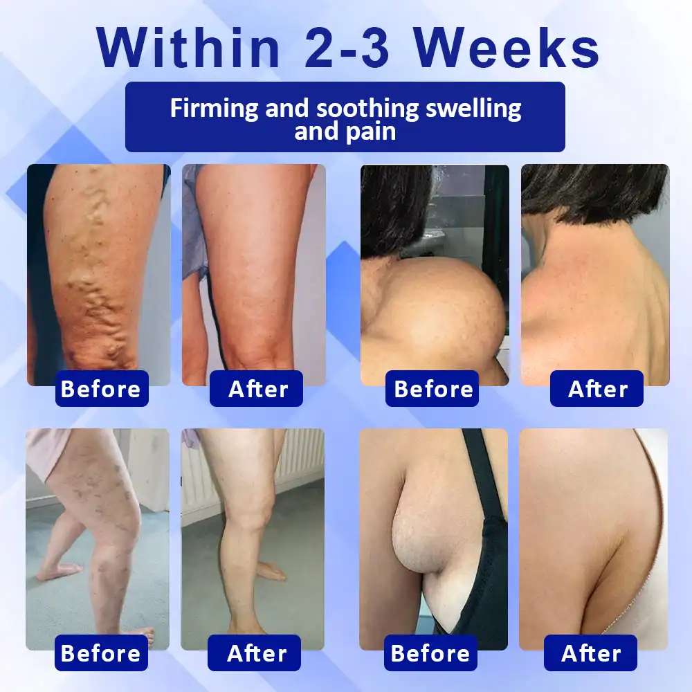 Elycura™ Lymphatic Drainage Massage Cream - Image 2