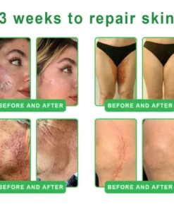 𝐎𝐫𝐢𝐚𝐜𝐡® 𝐀𝟏𝟎+ 𝟔-𝐢𝐧-𝟏 𝐃𝐞𝐫𝐦𝐚𝐑𝐞𝐩𝐚𝐢𝐫 𝐒𝐞𝐫𝐮𝐦