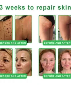 𝐎𝐫𝐢𝐚𝐜𝐡® 𝐀𝟏𝟎+ 𝟔-𝐢𝐧-𝟏 𝐃𝐞𝐫𝐦𝐚𝐑𝐞𝐩𝐚𝐢𝐫 𝐒𝐞𝐫𝐮𝐦