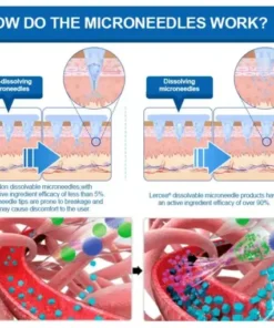 𝐓𝐢𝐫𝐳𝐞𝐩𝐚𝐭𝐢𝐝𝐞 & 𝐂𝐨𝐥𝐥𝐚𝐠𝐞𝐧 𝐍𝐚𝐧𝐨 𝐌𝐢𝐜𝐫𝐨𝐧𝐞𝐞𝐝𝐥𝐞 𝐖𝐞𝐢𝐠𝐡𝐭 𝐋𝐨𝐬𝐬 𝐏𝐚𝐭𝐜𝐡