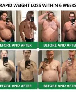 𝑵𝒂𝒏𝒐 𝑴𝒊𝒄𝒓𝒐𝒏𝒆𝒆𝒅𝒍𝒆 𝑷𝒂𝒕𝒄𝒉 𝒘𝒊𝒕𝒉 𝑺𝑴𝑮𝑻-𝑮𝑳𝑷-1 & 𝑴𝒂𝒕𝒓𝒊𝒙𝒚𝒍 3000