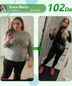 𝑵𝒂𝒏𝒐 𝑴𝒊𝒄𝒓𝒐𝒏𝒆𝒆𝒅𝒍𝒆 𝑷𝒂𝒕𝒄𝒉 𝒘𝒊𝒕𝒉 𝑺𝑴𝑮𝑻-𝑮𝑳𝑷-1 & 𝑴𝒂𝒕𝒓𝒊𝒙𝒚𝒍 3000