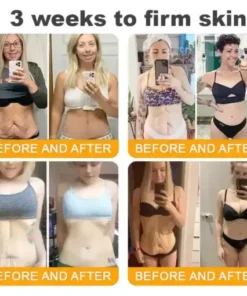 𝐁𝒆𝒆 𝐕𝒆𝐧𝐨𝐦 𝐂𝐨𝐦𝐩𝐫𝒆𝐡𝐞𝐧𝐬𝐢𝐯𝐞 𝐒𝐤𝐢𝐧 𝐑𝒆𝐬𝐭𝐨𝐫𝐚𝐭𝐢𝐨𝐧 𝐂𝐫𝒆𝐚𝐦