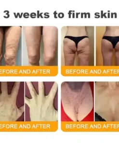 𝐁𝒆𝒆 𝐕𝒆𝐧𝐨𝐦 𝐂𝐨𝐦𝐩𝐫𝒆𝐡𝐞𝐧𝐬𝐢𝐯𝐞 𝐒𝐤𝐢𝐧 𝐑𝒆𝐬𝐭𝐨𝐫𝐚𝐭𝐢𝐨𝐧 𝐂𝐫𝒆𝐚𝐦