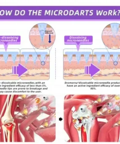 𝑀𝑒𝑔𝑙𝑢𝑡𝑖𝑑𝑒 & 𝐵𝑜𝑡𝑜𝑥 𝑁𝑎𝑛𝑜-𝑚𝑖𝑐𝑟𝑜𝑛𝑒𝑒𝑑𝑙𝑒 𝐽𝑜𝑖𝑛𝑡 𝑃𝑎𝑡𝑐ℎ