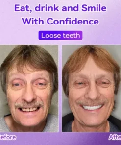 𝑇𝑒𝑒𝑡ℎ 𝑅𝑒𝑠𝑡𝑜𝑟𝑎𝑡𝑖𝑜𝑛 𝑀𝑖𝑛𝑒𝑟𝑎𝑙 𝑃𝑜𝑤𝑑𝑒𝑟