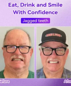 𝑇𝑒𝑒𝑡ℎ 𝑅𝑒𝑠𝑡𝑜𝑟𝑎𝑡𝑖𝑜𝑛 𝑀𝑖𝑛𝑒𝑟𝑎𝑙 𝑃𝑜𝑤𝑑𝑒𝑟