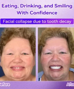 𝑇𝑒𝑒𝑡ℎ 𝑅𝑒𝑠𝑡𝑜𝑟𝑎𝑡𝑖𝑜𝑛 𝑀𝑖𝑛𝑒𝑟𝑎𝑙 𝑃𝑜𝑤𝑑𝑒𝑟