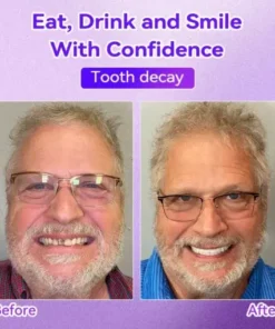 𝑇𝑒𝑒𝑡ℎ 𝑅𝑒𝑠𝑡𝑜𝑟𝑎𝑡𝑖𝑜𝑛 𝑀𝑖𝑛𝑒𝑟𝑎𝑙 𝑃𝑜𝑤𝑑𝑒𝑟