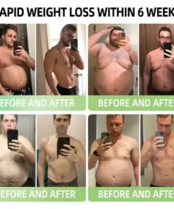 𝑵𝒂𝒏𝒐 𝑴𝒊𝒄𝒓𝒐𝒏𝒆𝒆𝒅𝒍𝒆 𝑷𝒂𝒕𝒄𝒉