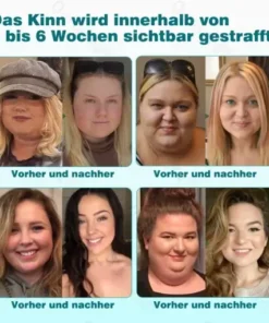 ๐๐ข๐ค๐ซ๐จ๐ง๐๐๐๐ฅ-๐๐๐ง๐จ๐ฉ๐๐ฅ๐๐ฌ๐ญ๐๐ซ