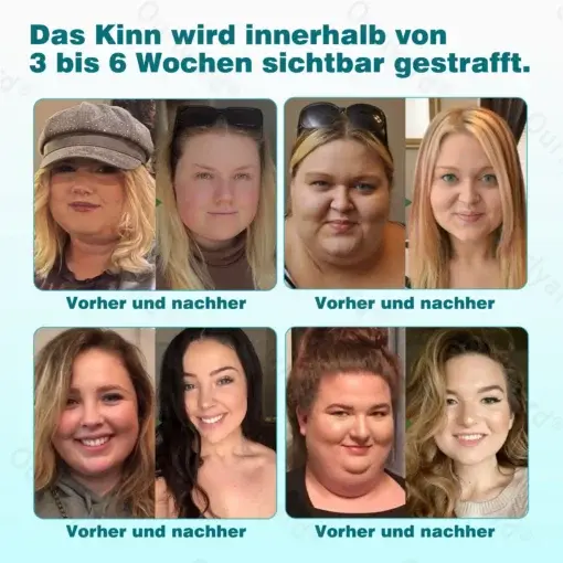 ๐๐ข๐ค๐ซ๐จ๐ง๐๐๐๐ฅ-๐๐๐ง๐จ๐ฉ๐๐ฅ๐๐ฌ๐ญ๐๐ซ