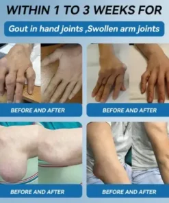 𝐉𝐨𝐢𝐧𝐭 𝐇𝐞𝐚𝐥𝐢𝐧𝐠 Capsules