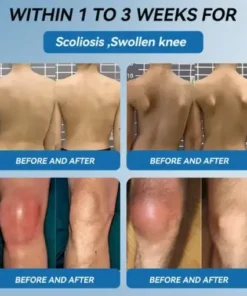 𝐉𝐨𝐢𝐧𝐭 𝐇𝐞𝐚𝐥𝐢𝐧𝐠 Capsules