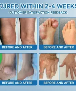 𝐉𝐨𝐢𝐧𝐭 𝐇𝐞𝐚𝐥𝐢𝐧𝐠 Capsules