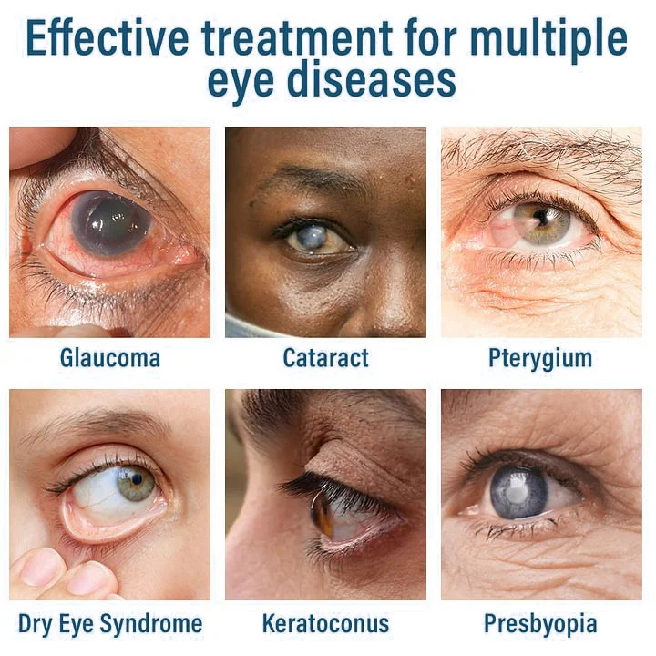 Docenin™ Nano Eye Drops Spray - Image 4