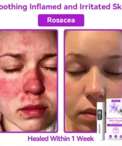 Advanced Non-Invasive Skin Repair CO₂ Laser Pen