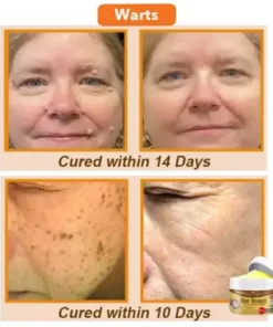 Bee Venom Comprehensive Cream