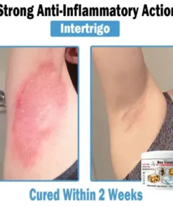 Bee Venom Multi-Symptom Skin Treatment Cream