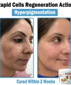 Bee Venom Multi-Symptom Skin Treatment Cream