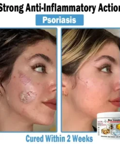 Bee Venom Multi-Symptom Skin Treatment Cream