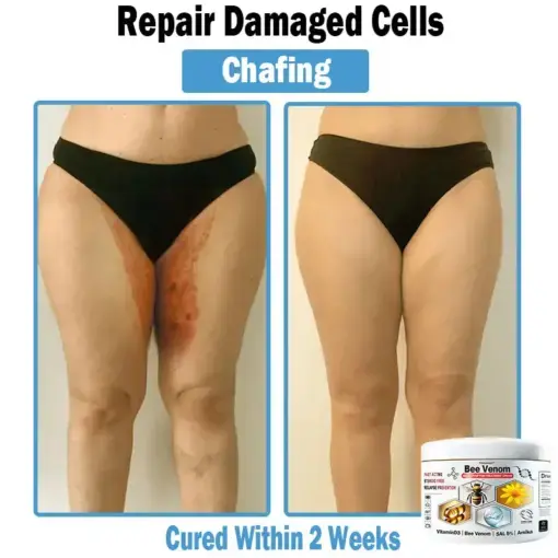 Bee Venom Multi-Symptom Skin Treatment Cream