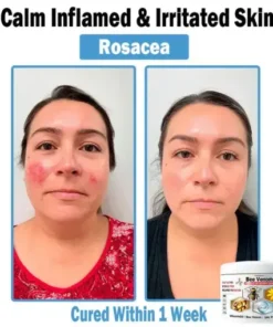 Bee Venom Multi-Symptom Skin Treatment Cream