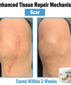 Bee Venom Multi-Symptom Skin Treatment Cream