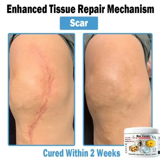 Bee Venom Multi-Symptom Skin Treatment Cream