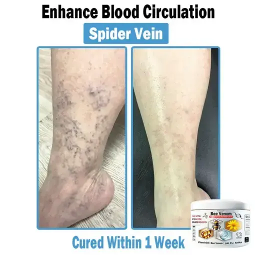 Bee Venom Multi-Symptom Skin Treatment Cream