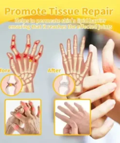 Bee-Venom Pain-Relief Bone Healing Cream