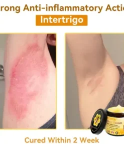 Bee Venom Repair Cream