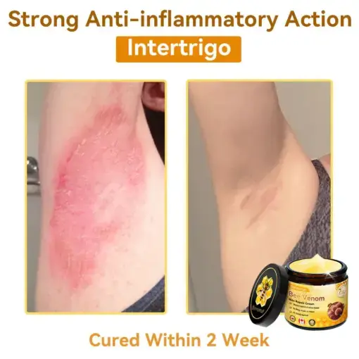 Bee Venom Repair Cream