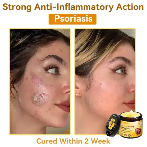 Bee Venom Repair Cream