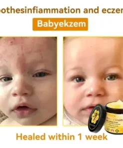 Bee Venom Repair Cream