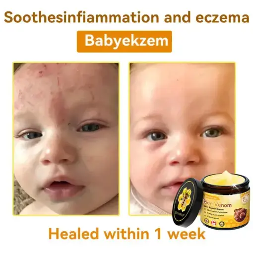 Bee Venom Repair Cream