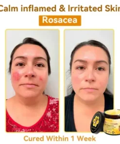 Bee Venom Repair Cream