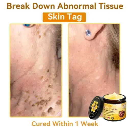 Bee Venom Repair Cream