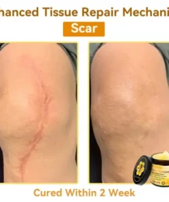 Bee Venom Repair Cream