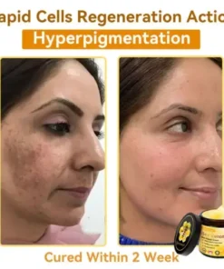 Bee Venom Repair Cream