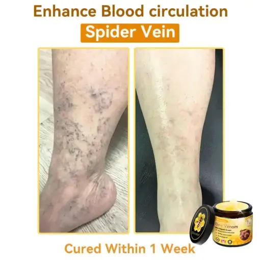 Bee Venom Repair Cream